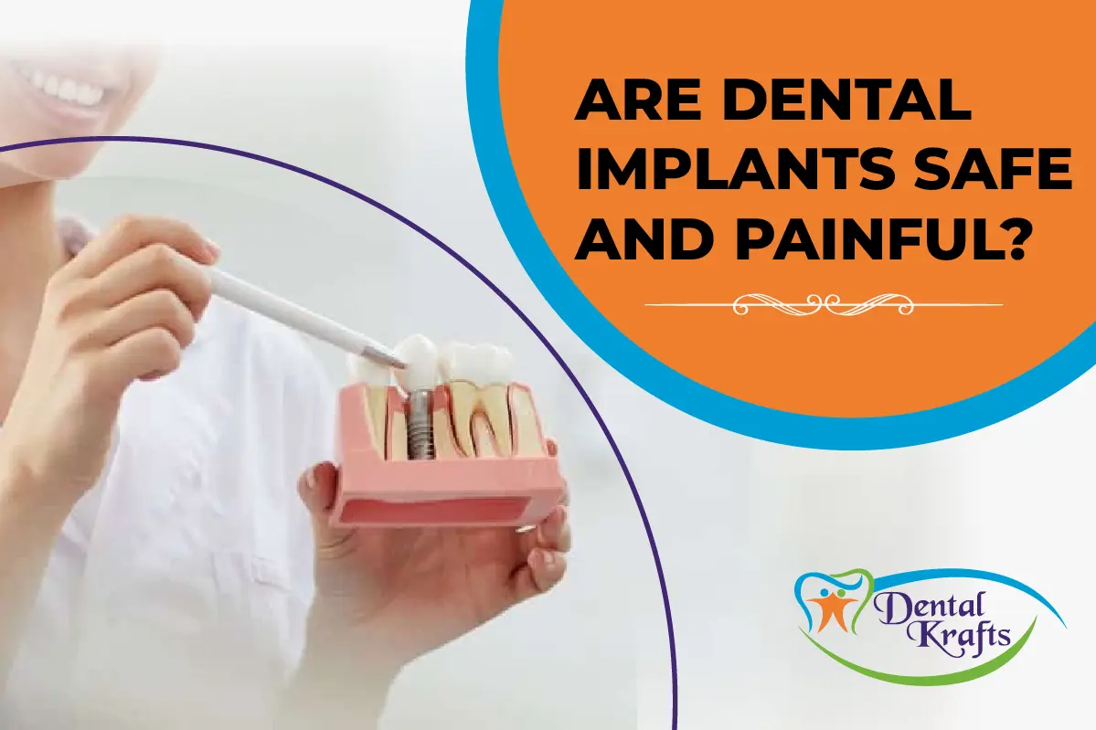 dental implants