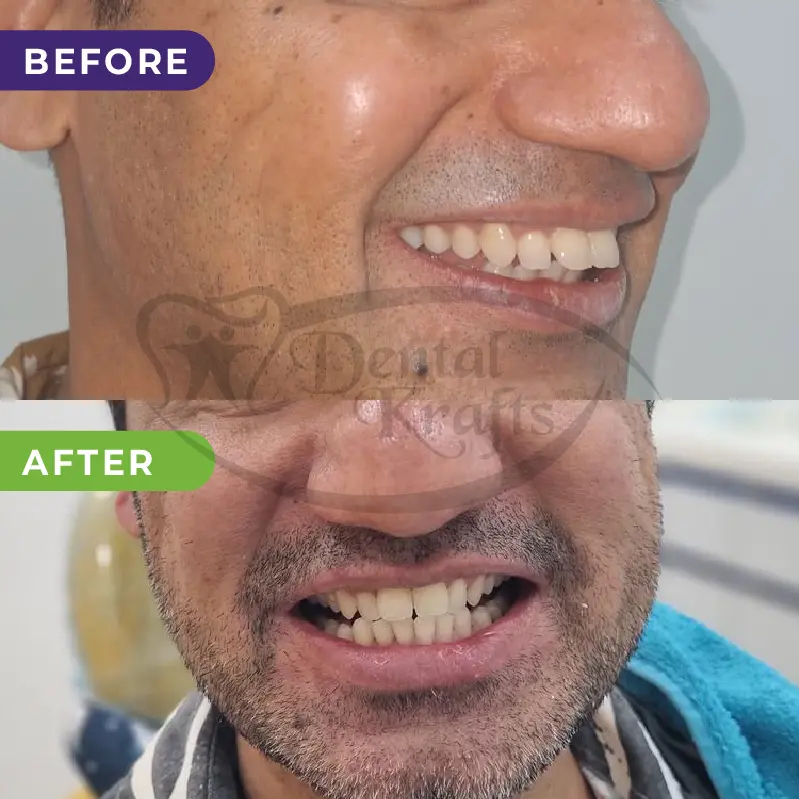 dental treatment gurgaon