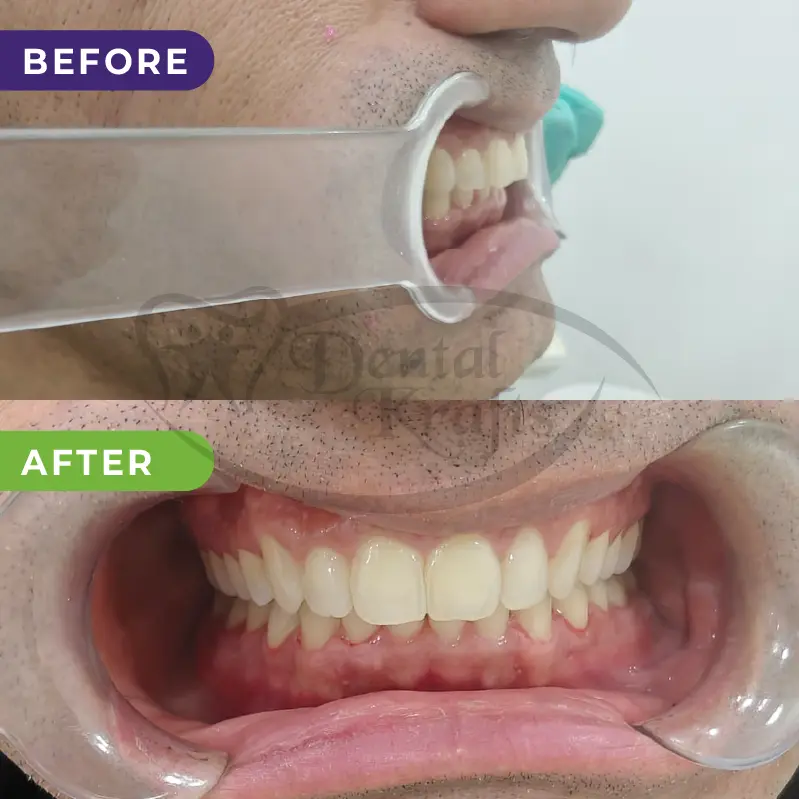 best dental treatment gurgaon