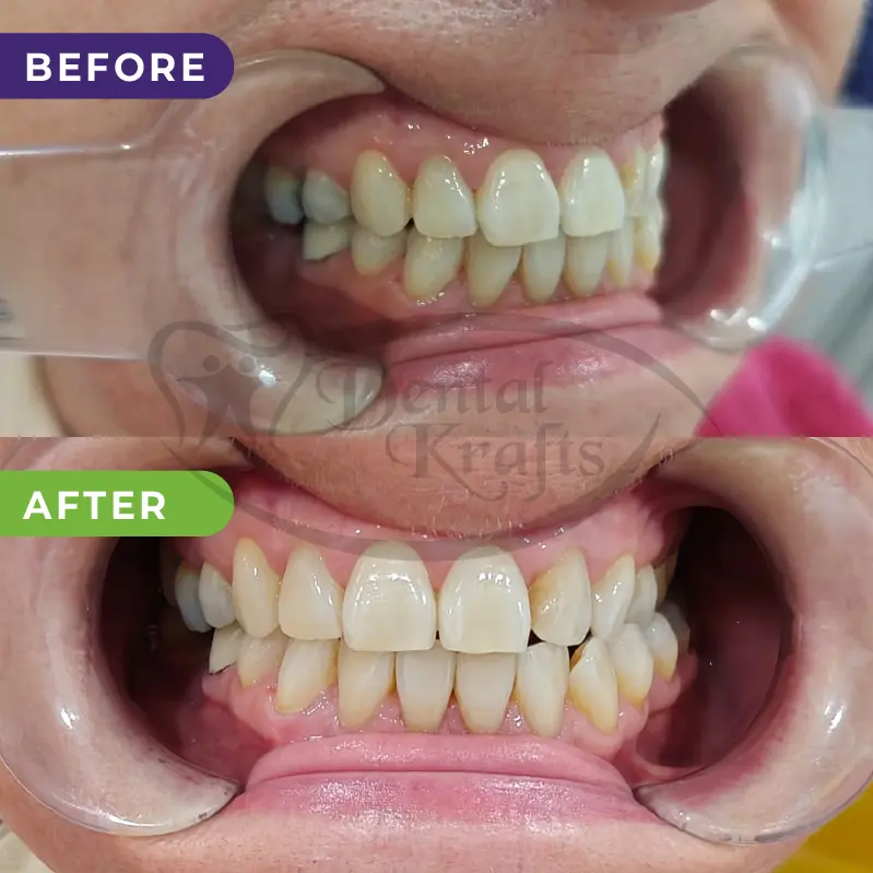 dental treatment gurgaon