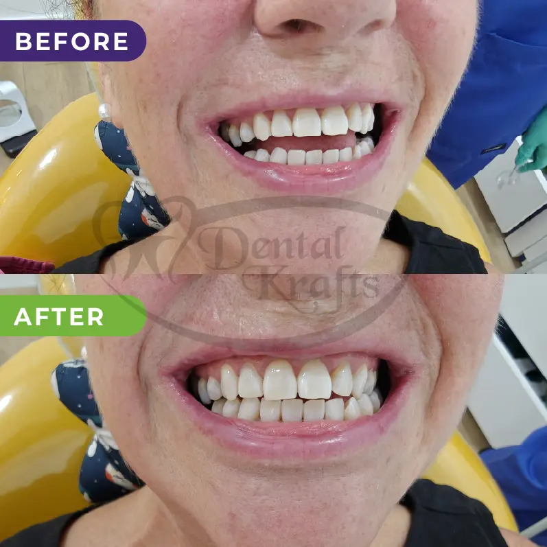 dental treatment gurgaon